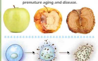 Oxidative stress